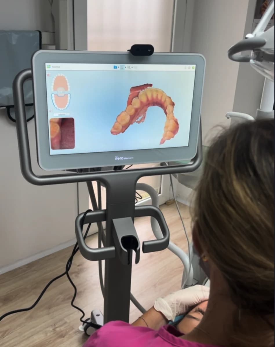 Escáner intraoral iTero Element en Clínica Dental Araque Las Rozas